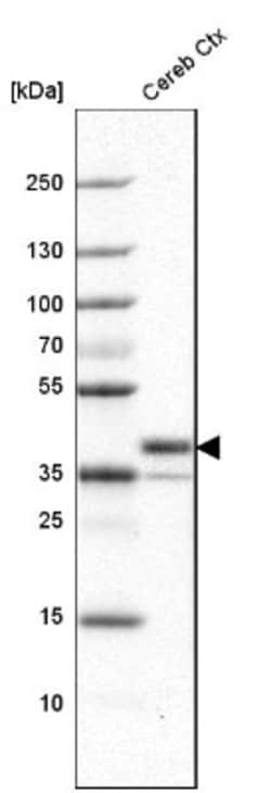 BAD-LAMP/LAMP5 Antibody, Novus Biologicals 0.1mL; Unlabeled:Antibodies,